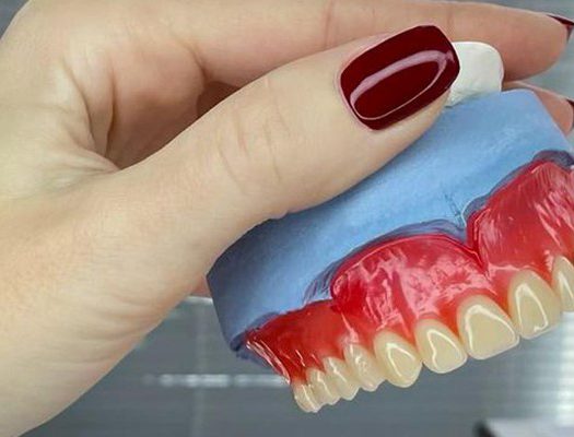 همه چیز درباره دندان مصنوعی