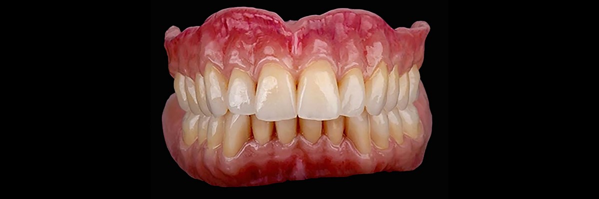 دندان مصنوعی تکه‌ای
